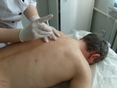 Injections intra-articulaires de chondroprotecteurs pour l'ostéochondrose thoracique